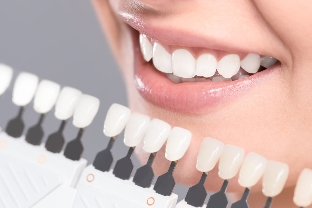 Teeth Whitening Clearwater FL