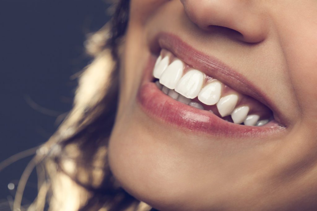 dental implants clearwater fl