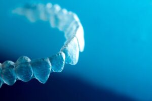 Know Your Invisalign Timeline