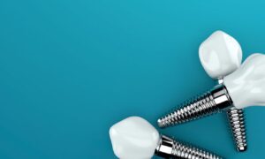 Comparing Implant Dentistry Options