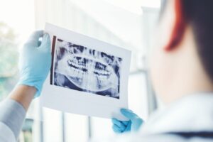 Why Should I Get a Dental X-Ray