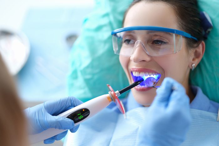 dental bonding in clearwater, florida