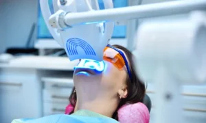 Professional teeth whitening has become increasingly popular for those seeking a radiant smile without the guesswork of at-home solutions.